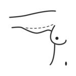arm