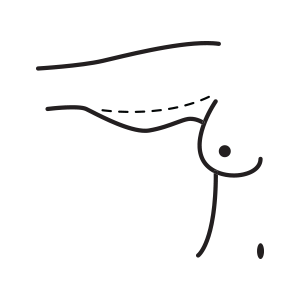 arm