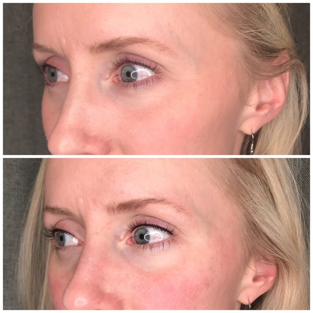 permanent-cosmetics